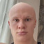 Erling Baaldand