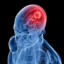 Brain Cancer Gaming