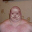 Thumbie (tumor of Timmy)