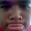 DOGFACE