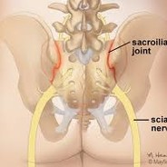 Sacroiliac Joint