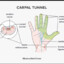 carpalFunnel