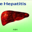 Autoimmune hepatitis
