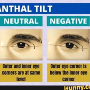 Negative Canthal Tilt