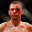 Nate Diaz