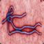 Ebola_De_Cal