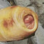 foreskin peek