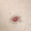 Priesty&#039;s left nipple