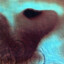 Meddle