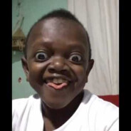 ME PICA LA BOLA DERECHA