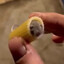 Squamous McFigglenut