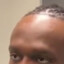 KSI&#039;s forehead