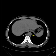 Rheumatologist, MD , IM