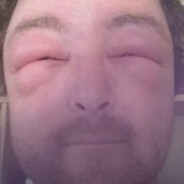 ужаленный пидор