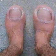 изподвыподвертус