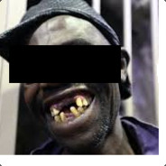 Codein mit Fanta - steam id 76561198376760736