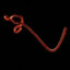 Ebola