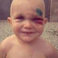 autist kid