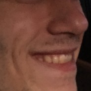 DDD