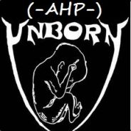 UNb0Rn - steam id 76561197960286682