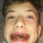 Fabianooo CASEDROP.eu