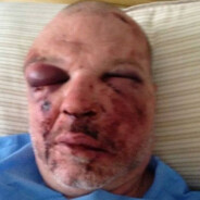 Yommana Bergstå