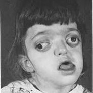 [REKT] dooftard the second