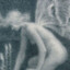▲
