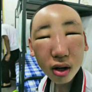 猛踹瘸子那条好腿