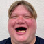 D1mple