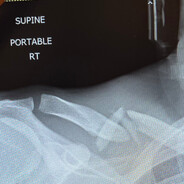 Bone