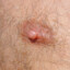 Man&#039;s Areola