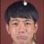 肺痒痒