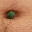 Lint