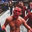 Nate Diaz