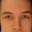 baldman1