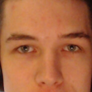 baldman1