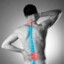 Chronic back pain