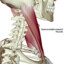 Sternocleidomastoid