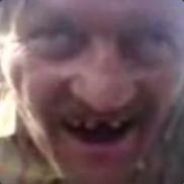 ҳ̸Ҳ̸ҳ Czubek ҳ̸Ҳ̸ҳ