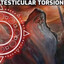 testicular torsion
