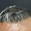 el chiqui