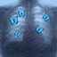 abdrm