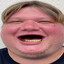 P1mple