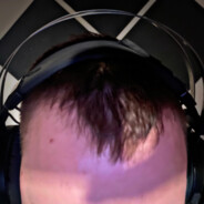 _CALVO_