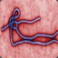 bdp: Ebola