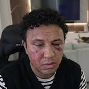 кимпинтяо братиш