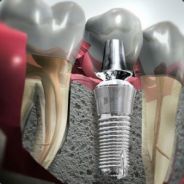 Teeth_BR - steam id 76561197964334309