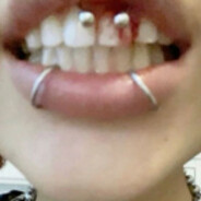 умиротворение