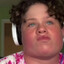im disabled